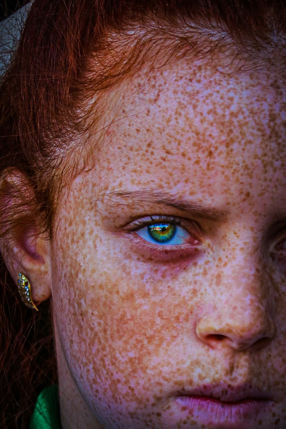 Close-up of freckled skin on a cheek